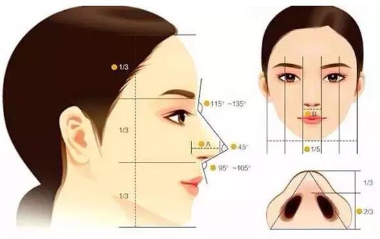 矫正鼻形可以改善面相 隆鼻的手术方式：玻尿酸注射隆鼻和手术鼻型矫正