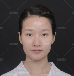 全球顶级鼻修复专家：北京刘彦军和韩国郑东学哪个做高难度鼻修复效果好？