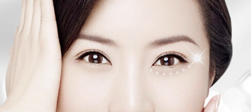 韩式双眼皮(吊线/埋线)手术时间多长？韩式双眼皮(吊线/埋线)需要全身麻醉吗？