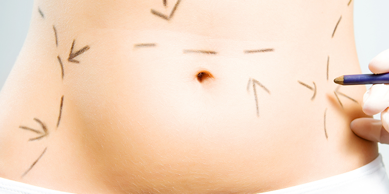 什么是胃水球减肥？胃水球减肥术前术后注意事项有哪些？