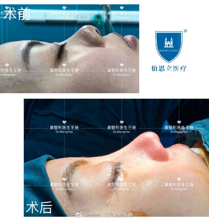 2020年上海做鼻子的知名专家 2020年上海隆鼻鼻综合预约医生排名