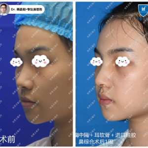 上海做鼻子哪个医生做得好？上海做鼻子医生预约排名