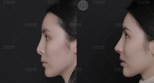 北京有没有靠谱的鼻子整容的医生预约排行榜