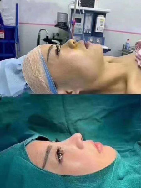 上海九院哪个医生做鼻子好？戴传昌是技术最好的吗？