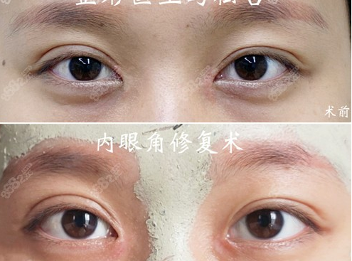 广州最擅长做眼部修复的医生排名预约大全