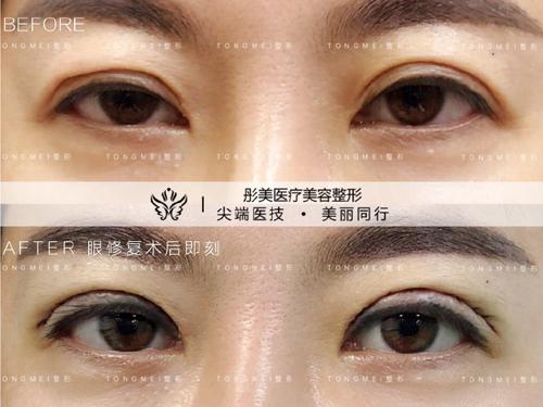 中国的眼部修复最好的专家是哪个？韩勋、张冰洁、王振军、刘风卓