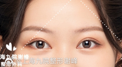 上海眼整形专家谢峰做双眼皮怎么样？