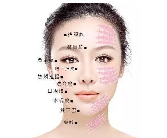 深圳妍熙李静做的面部线雕提升怎么样？