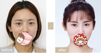 南京双眼皮修复权威专家排行榜 南京最好的双眼皮修复专家排名 南京最好的双眼皮修复专家有哪些？