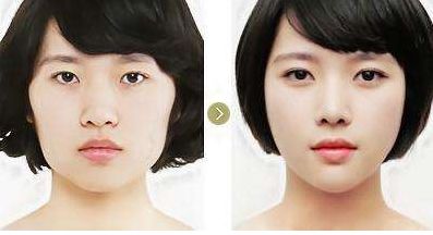 全中国最好的改脸型专家有哪些？改脸型整形医生排行榜