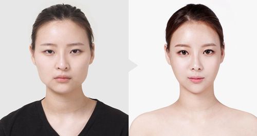 中国最好的眼整形和眼修复专家：刘志刚（简介、案例、预约）