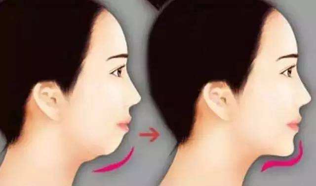 广州做鼻子整容最好的整形医生是谁呀？大概需要多少钱？