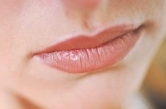 唇部整形的常见问题