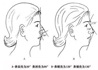 塌鼻子整形的方法以及术后护理有哪些注意的吗？