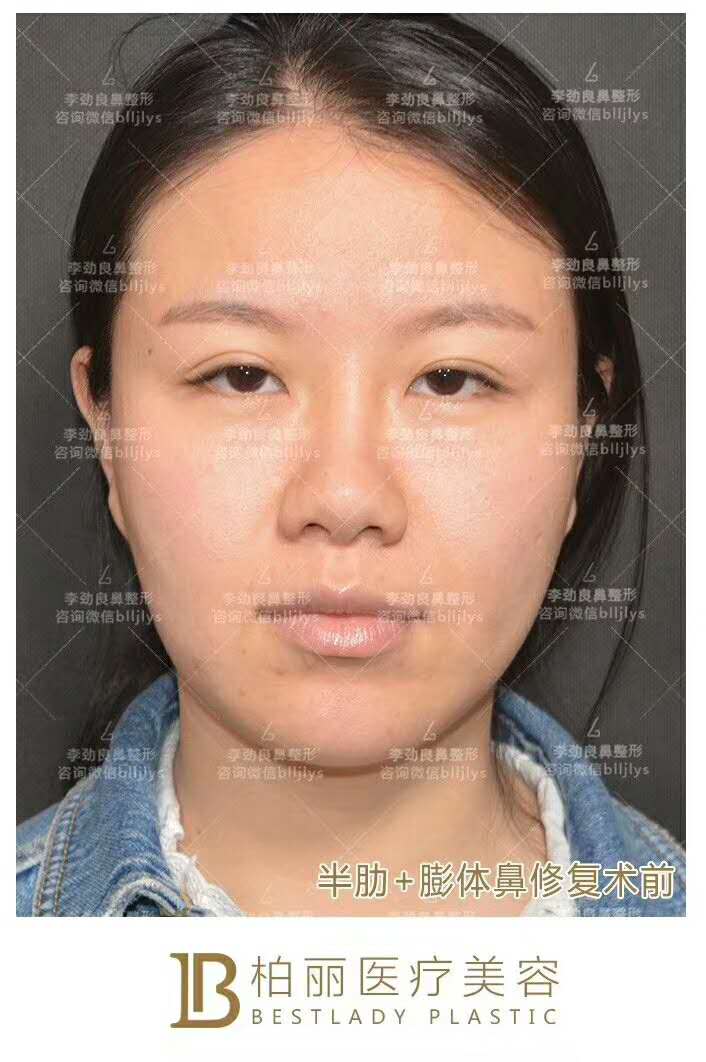 北京鼻修复专家有谁？最厉害的鼻修复专家必看！