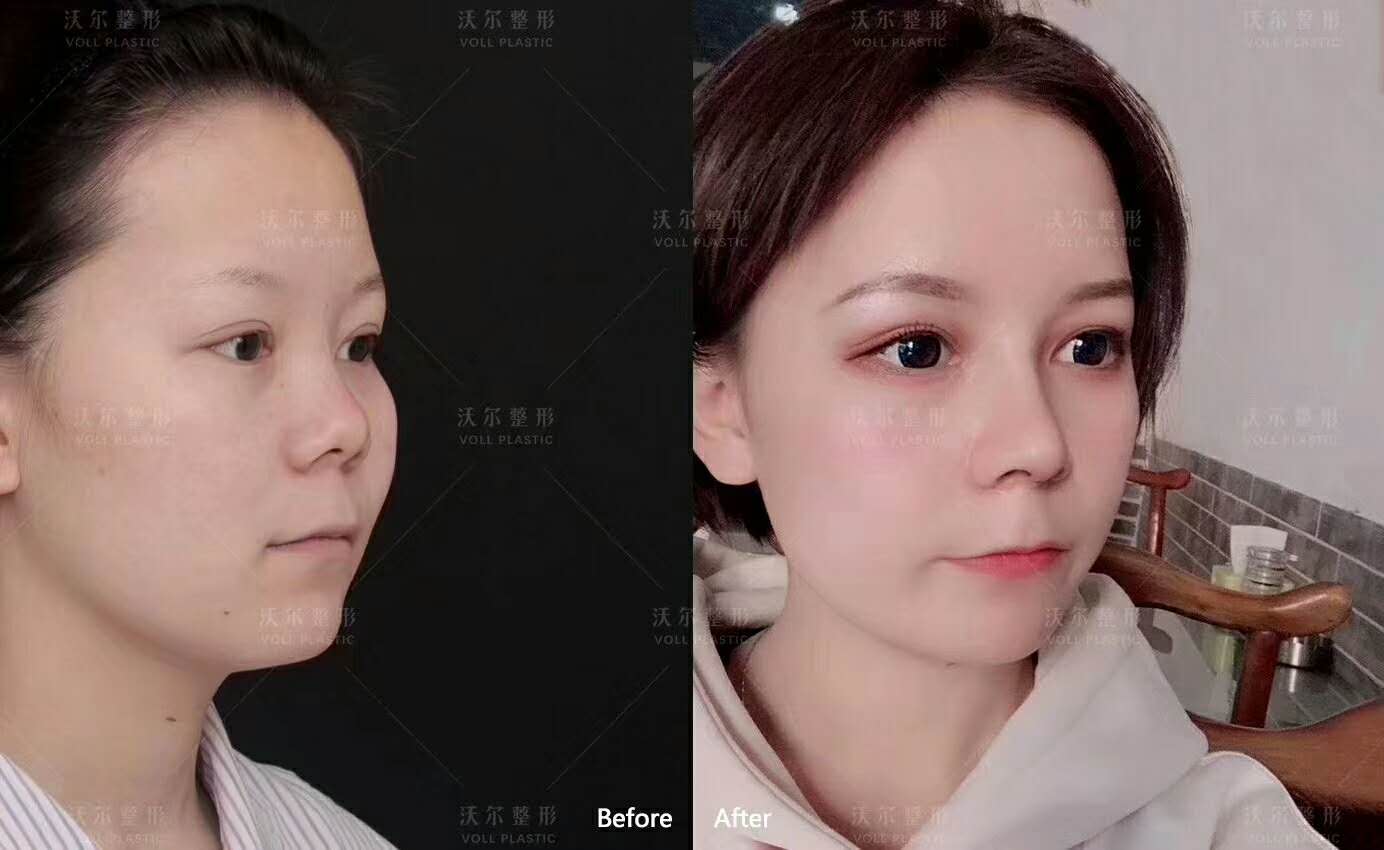 北京鼻修复专家有谁？最厉害的鼻修复专家必看！