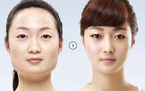 上海九院改脸型专家哪个最厉害？韦敏、柴岗、戴传昌、张路、俞哲元怎么样？