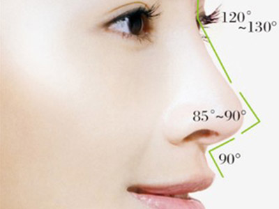 你对鼻形矫正有多少认识？鼻型矫正和隆鼻是一回事吗？