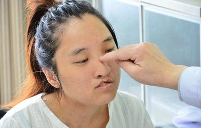 北医三院赵振民：唇腭裂可以治愈吗?唇腭裂什么时候治疗好?