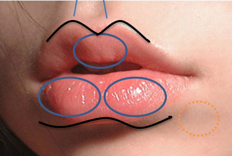 嘴唇的整形包括什么？缩唇、丰唇、唇线