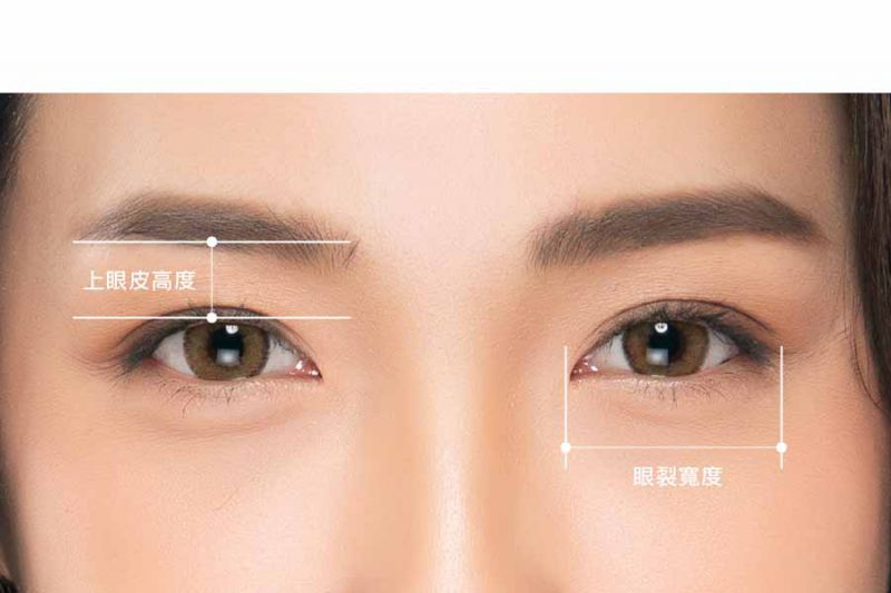 什么是欧式双眼皮？欧式双眼皮和韩式双眼皮哪个更好？