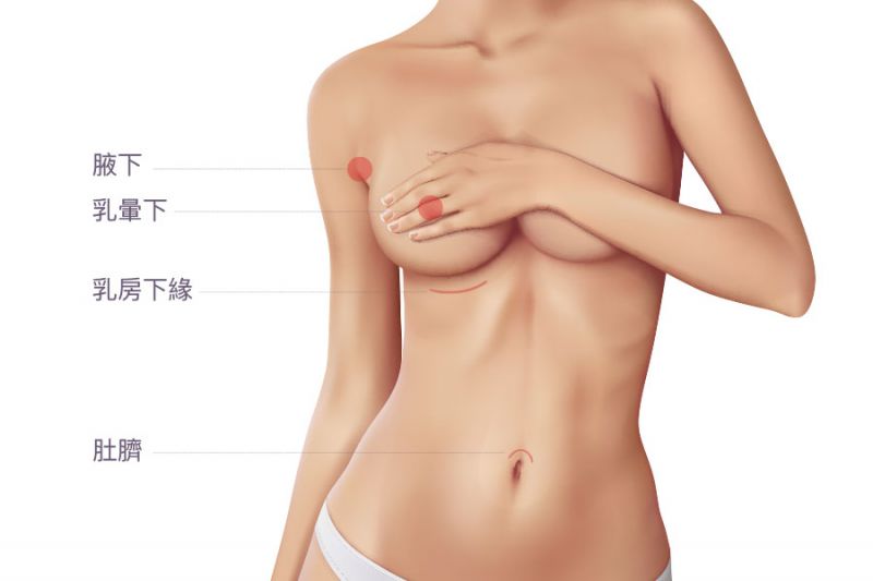 什么是果冻硅胶假体？丰胸手术切口在腋下还是乳晕？