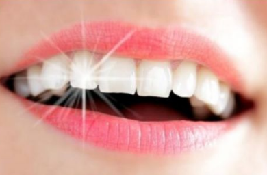 西安艺星口腔整齐洁白的牙齿，展现你迷人的笑颜
