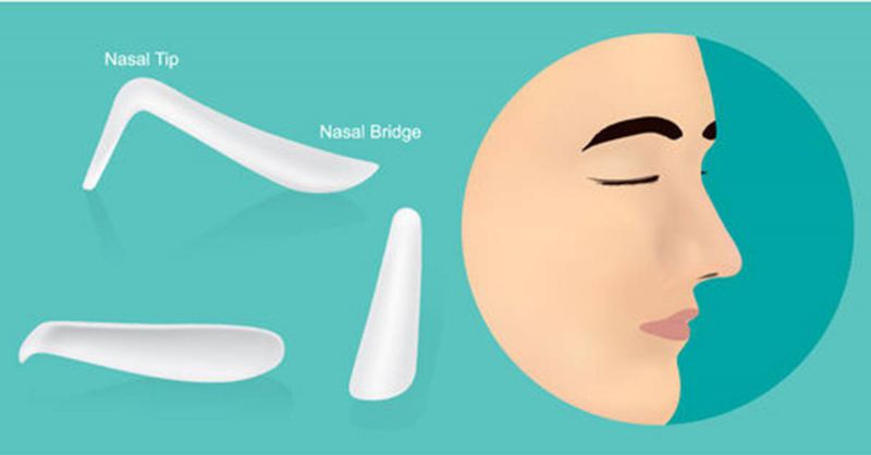 隆鼻材质|隆鼻材料如何选择？常见隆鼻材质介绍
