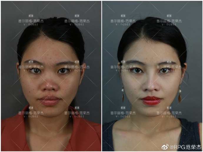 2020年上海做鼻子的知名专家 2020年上海隆鼻鼻综合预约医生排名