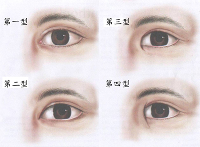 开眼头手术能让眼睛变大吗？开眼头疤痕合并双眼皮可以吗？
