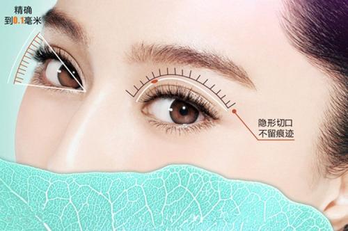 日式订书针双眼皮手术缝双眼皮和割双眼皮有什么区别？