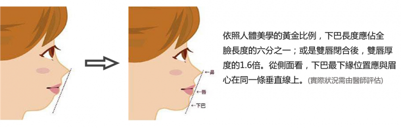 脸型脸颊肌肉下巴和牙齿咬合问题可以做下巴整形改善吗？