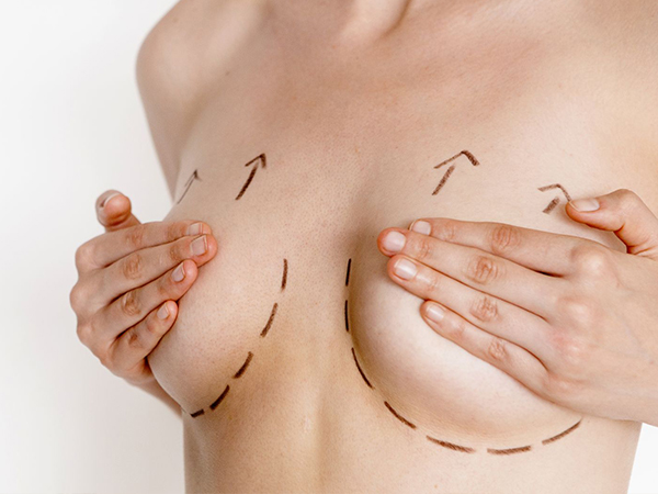 自体脂肪移植隆胸一次可以提升多少罩杯？脂肪隆胸注意事项有哪些？