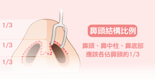 韩式隆鼻和卡麦拉隆鼻有哪些优点？