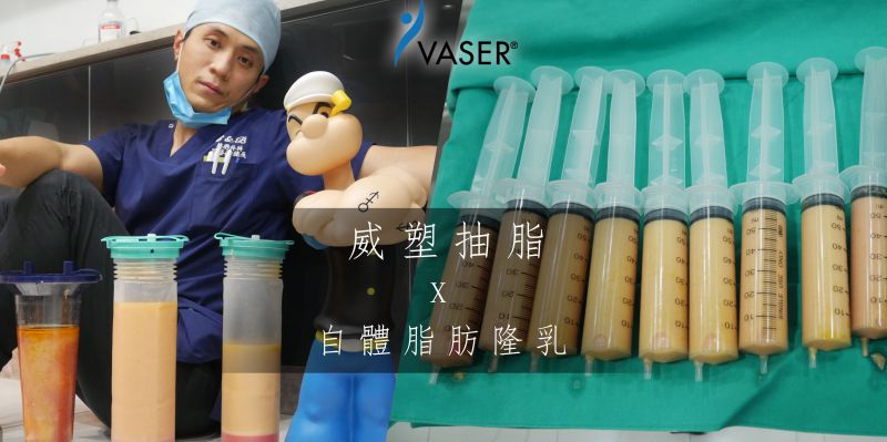 Vaser2.2威塑抽脂独特优势有哪些？为什么选择威塑抽脂？