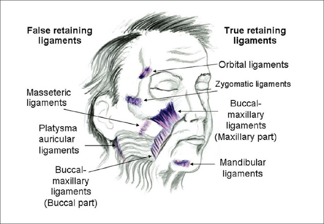 脸型下垂有什么免动刀的手术方法吗？玻尿酸True Lift真性韧带拉皮