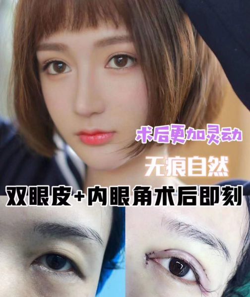上海九院双眼皮哪个医生比较好？上海九院双眼皮多少钱？