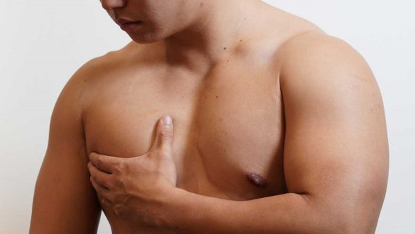 男性女乳症治疗方法有哪些？