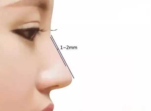 完美的鼻型是怎样的？传统一段式隆鼻二段式隆鼻优缺点有哪些？
