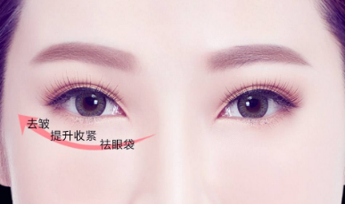 上海九院眼袋切除哪个医生做的最好？