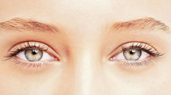 怎样选择双眼皮手术医生？双眼皮的恢复期有多久？