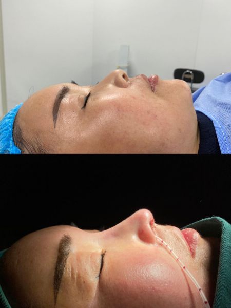 北京八大处鼻修复谁做得好？八大处鼻修复最好的医生预约排名
