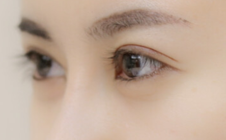 上海九院做双眼皮哪个专家最好？九院双眼皮专家预约排名