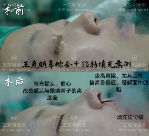 北京八大处隆鼻哪个医生做的最好？