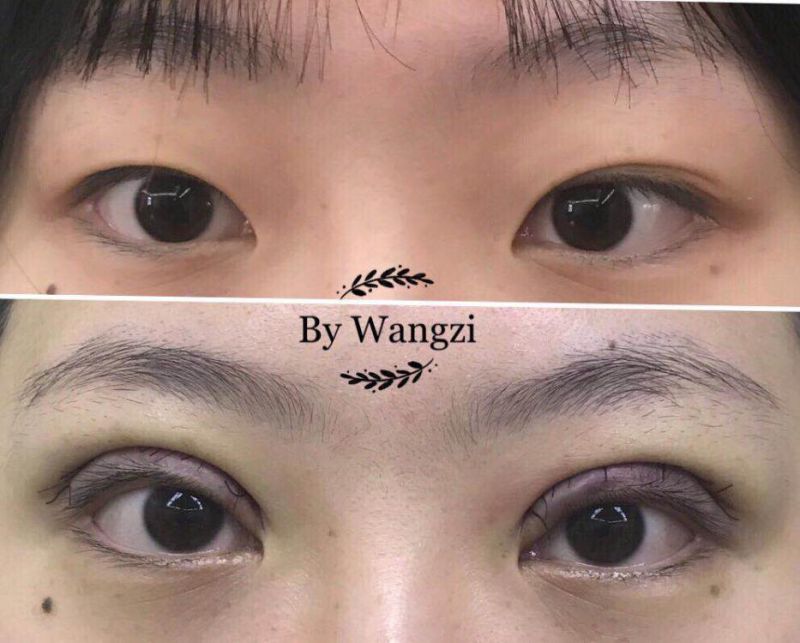 上海九院双眼皮修复专家是谁？九院双眼皮修复医生预约排名
