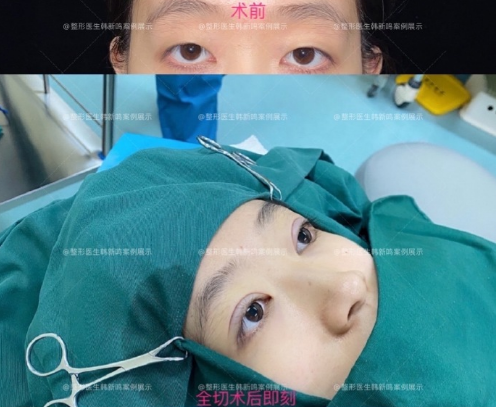 北京眼综合做的好的医生是哪个？