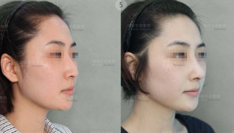 中国最好的鼻子修复整形医生有哪些？