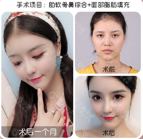 中国鼻部整形专家排名前十 中国鼻部整形医生排名前十名