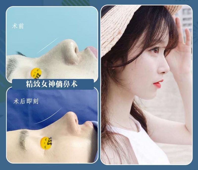 重庆做鼻子最有名的医生是哪个？重庆做鼻子专家排行榜