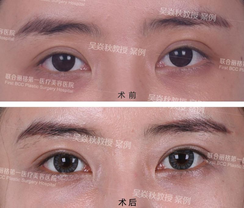北京最有名的眼修复专家都有哪些？